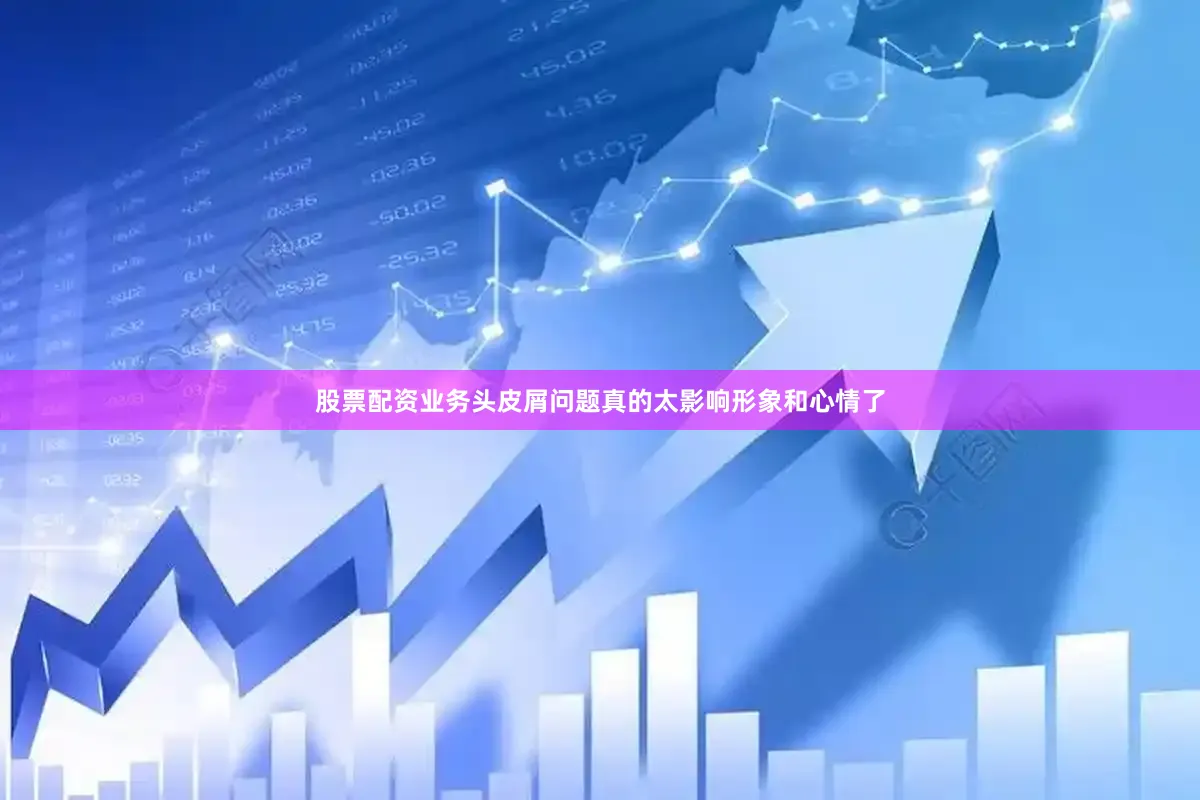股票配资业务头皮屑问题真的太影响形象和心情了